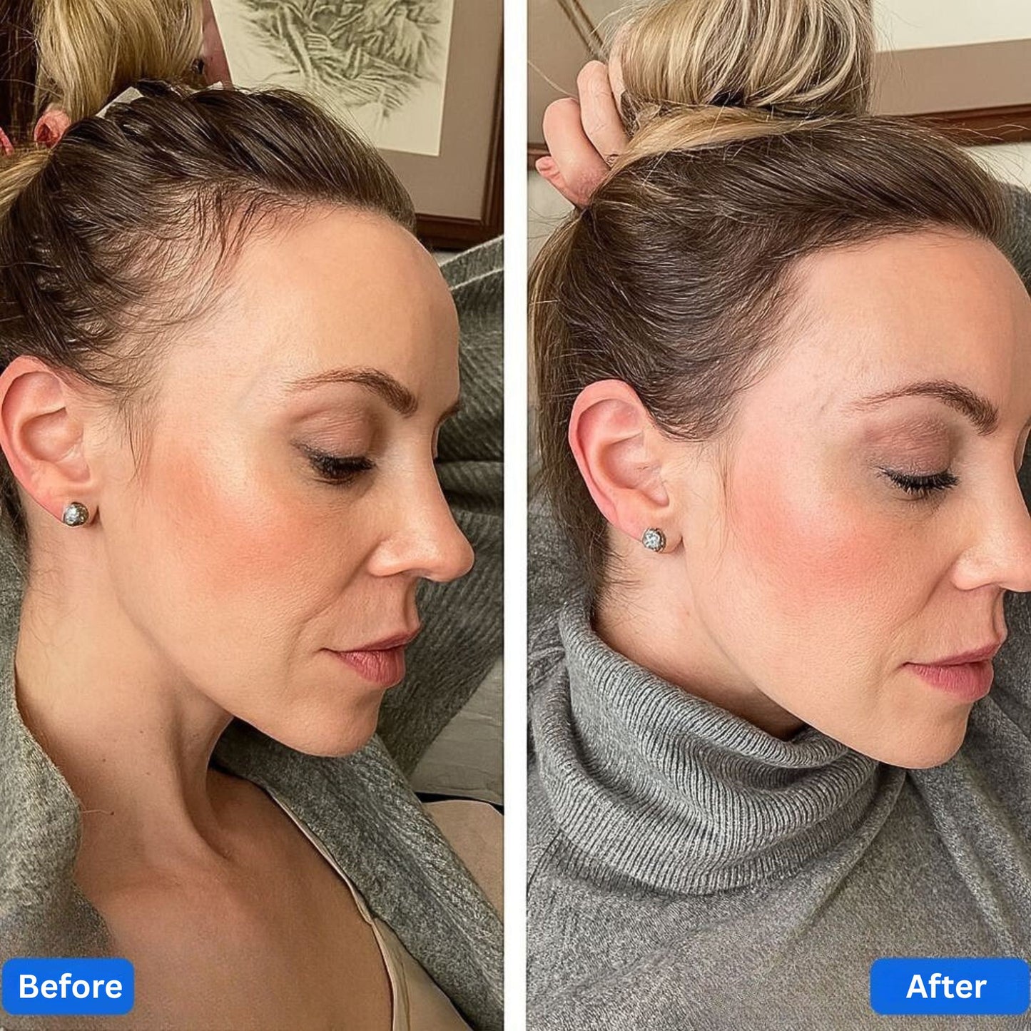 Hair Growth Serum for Thinning Hair & Hair Loss