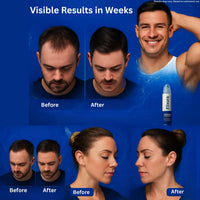 Hair Growth Serum for Thinning Hair & Hair Loss